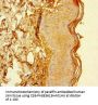 CYREN Antibody