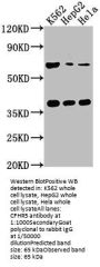 CFHR5 Antibody