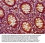 BACH2 Antibody