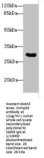 Snrnp35 Antibody