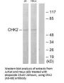 CHEK2 (Ab-68) Antibody