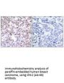 CHEK2 (Ab-68) Antibody