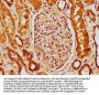 BCL2L10 Antibody