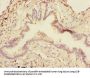 DCP1A Antibody
