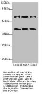 DCP1A Antibody