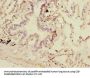 DCP1A Antibody