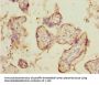 DCP1A Antibody