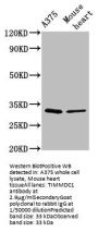 TIMMDC1 Antibody