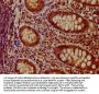 TIMMDC1 Antibody
