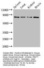 PRMT7 Antibody