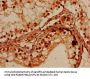 PRMT7 Antibody