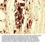 POLR3B Antibody
