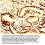 POLR3B Antibody