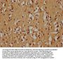 ZIM2 Antibody