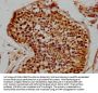 ZIM2 Antibody