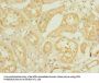 KLHL42 Antibody