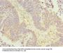 KLHL42 Antibody