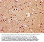 TCF20 Antibody