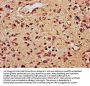 TCF20 Antibody