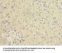 IL20RA Antibody