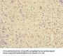 IL20RA Antibody
