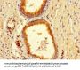 BAIAP2L1 Antibody