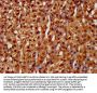 LARP6 Antibody