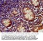 LARP6 Antibody