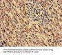MECR Antibody