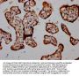 RIOK2 Antibody