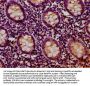 RIOK2 Antibody