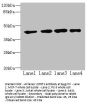 QTRT1 Antibody
