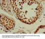 MAP1LC3B Antibody