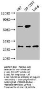 NEUROG2 Antibody