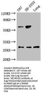 NEUROG2 Antibody