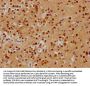 ADNP Antibody