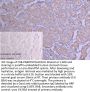 FAM83D Antibody