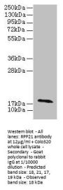 RPP21 Antibody