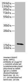 RPP21 Antibody