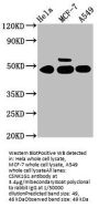 CSNK1G1 Antibody