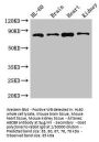 ABCB9 Antibody