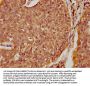 SPINK5 Antibody