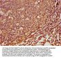 SPINK5 Antibody