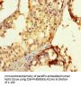 EXOSC3 Antibody