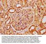 POLE4 Antibody
