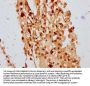 POLE4 Antibody