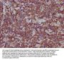 DROSHA Antibody
