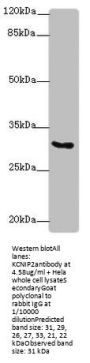 KCNIP2 Antibody