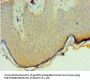 PNPLA3 Antibody