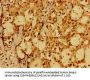 FAIM Antibody